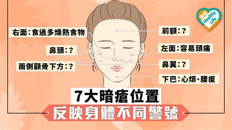 肚皮生瘡|【暗瘡位置】不同代表什麼？中醫教如何處理及預防